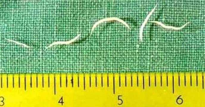 A pinworms a féreg leggyakoribb típusa kisgyermekeknél. 