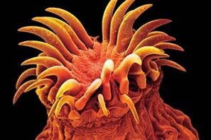 Trematoda paraziták emberben