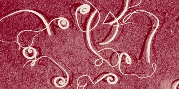 fénykép emberi parazitákról