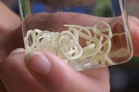 paraziták az emberi testből